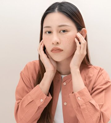 Pigmentation & Melasma
