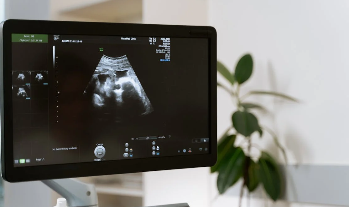 a screen with an ultrasound image