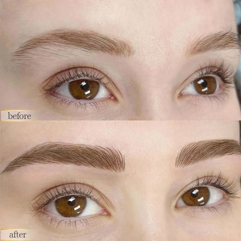 Neutral Before and After Instagram Post 768x768