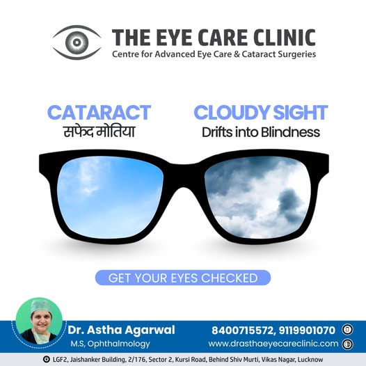 eye care dddd